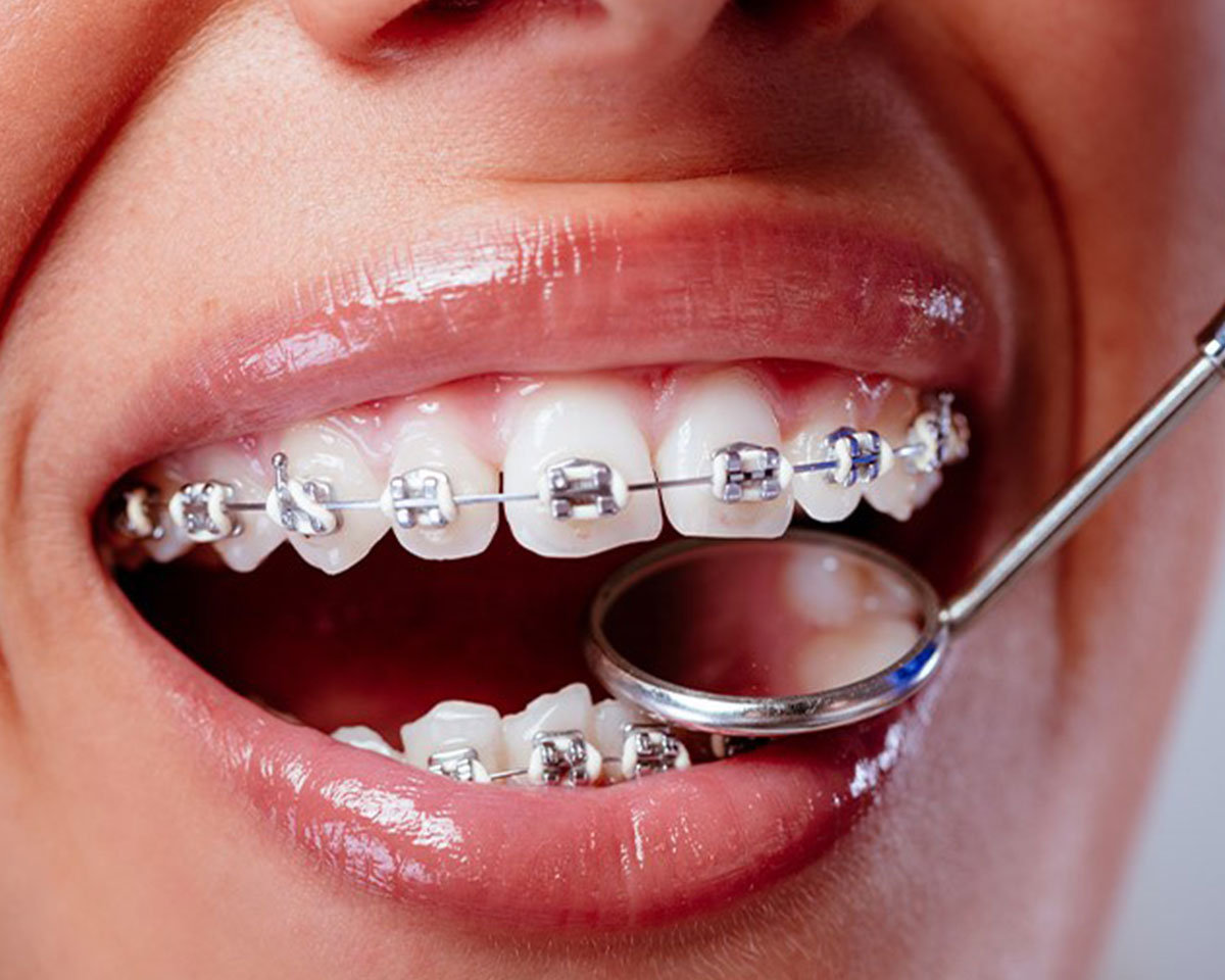 dental-orthodontics