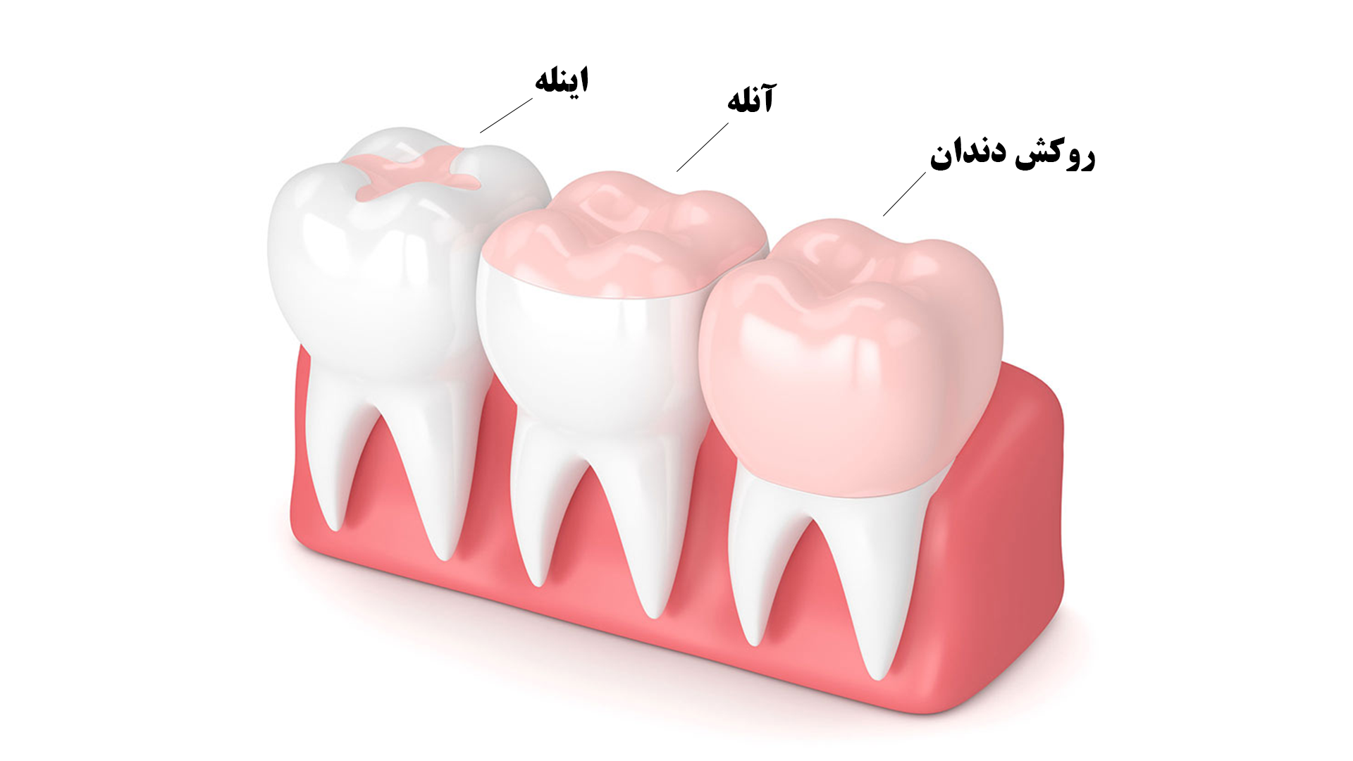 اینله و آنله