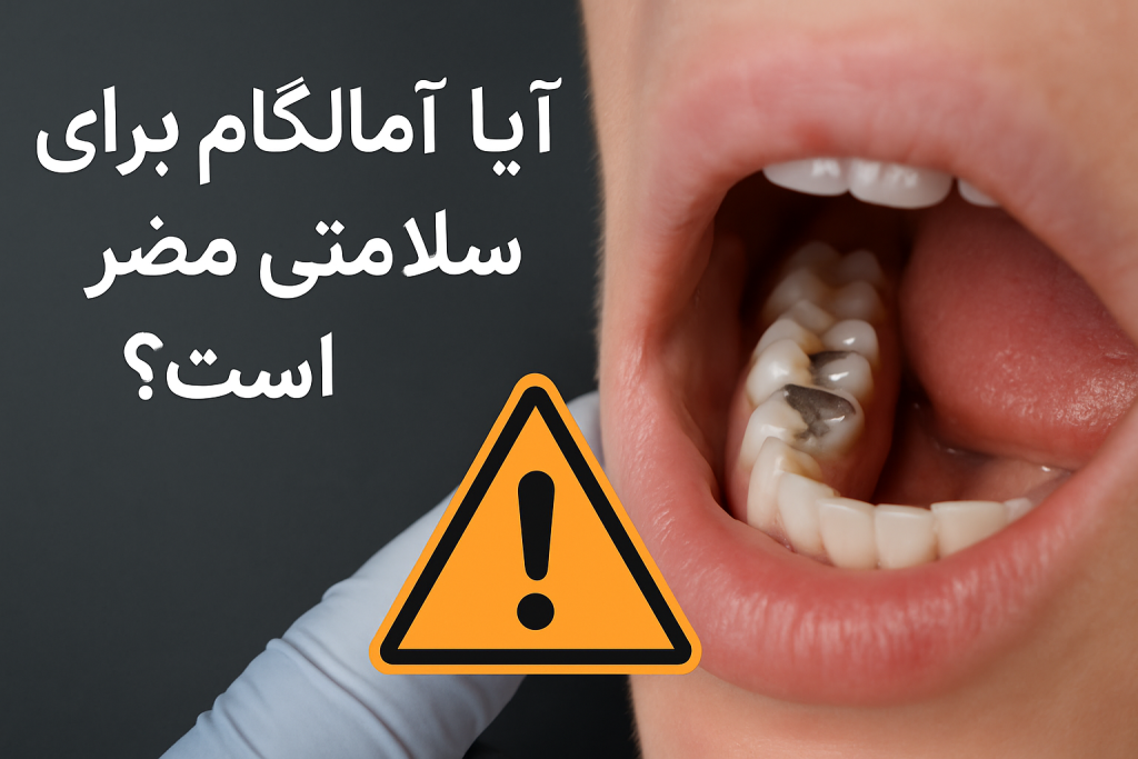 آیا آمالگام برای سلامتی مضر است؟