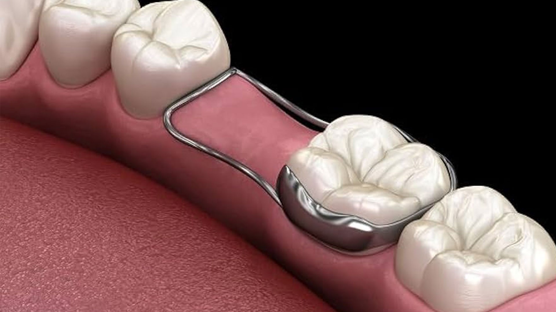فضای نگهدارنده اطفال