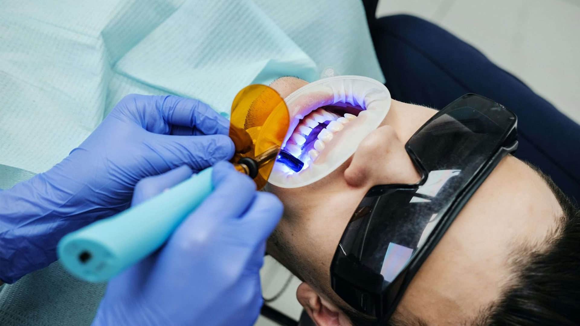 روش لیزری برای جرم گیری