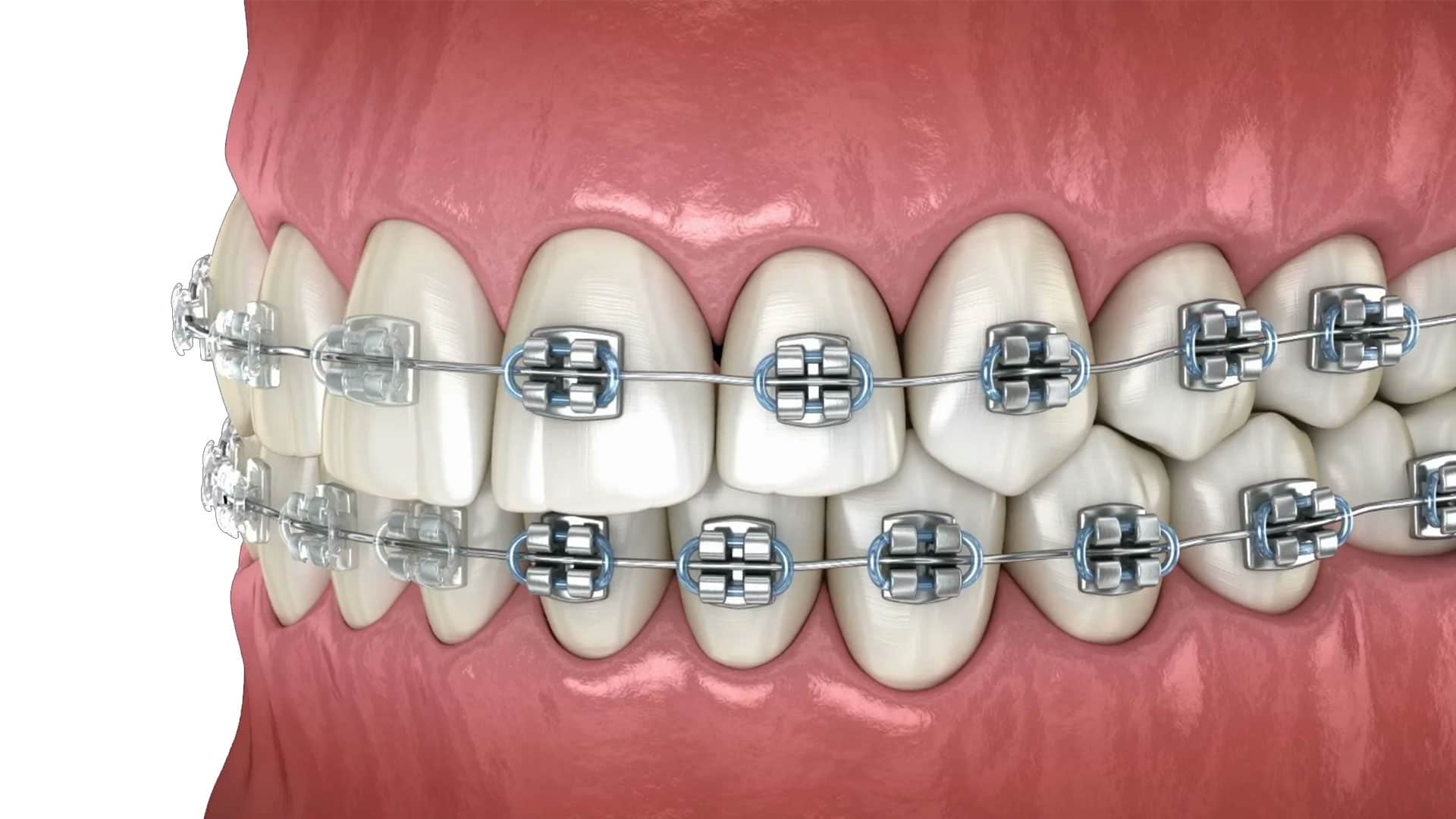 فک و ارتودنسی