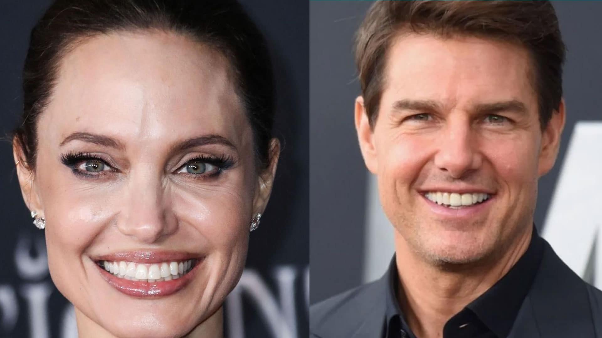 لمینت دندان سلبریتیها