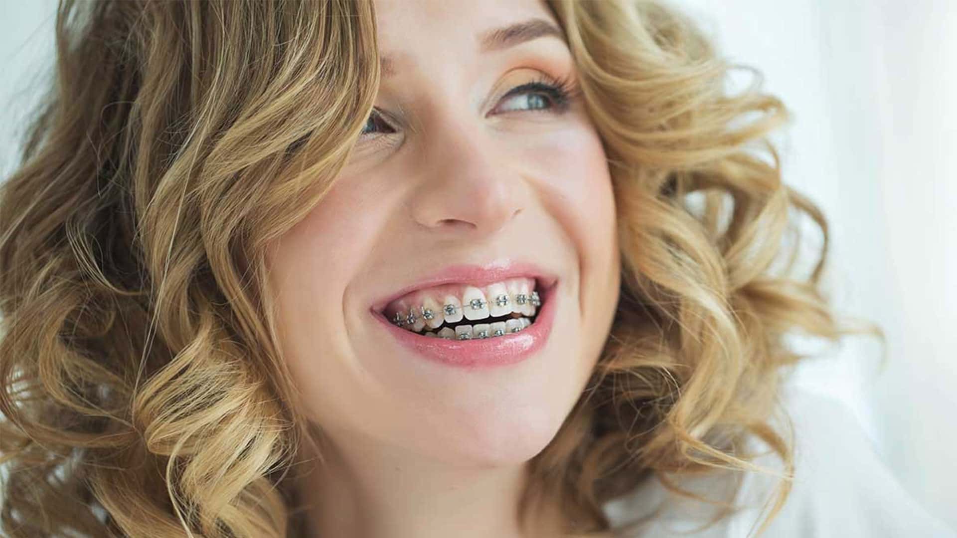 چهره خانم زیبا با ارتودنسی