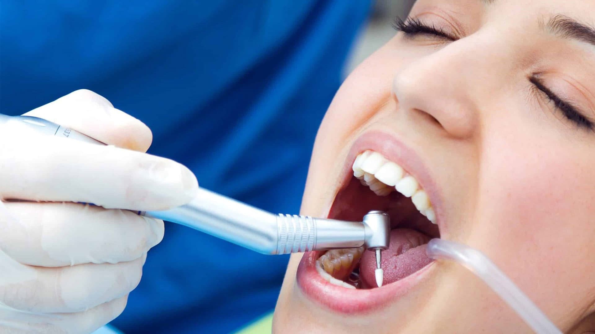 ابزارهای دندانپزشکی