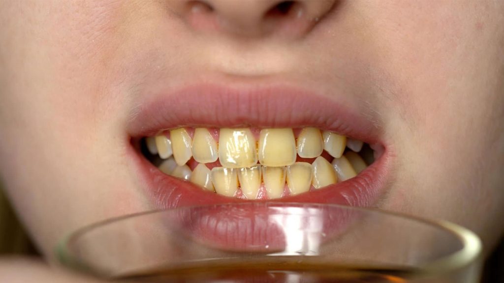 تأثیر چای بر دندان