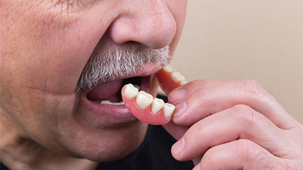 دندان مصنوعی متحرک