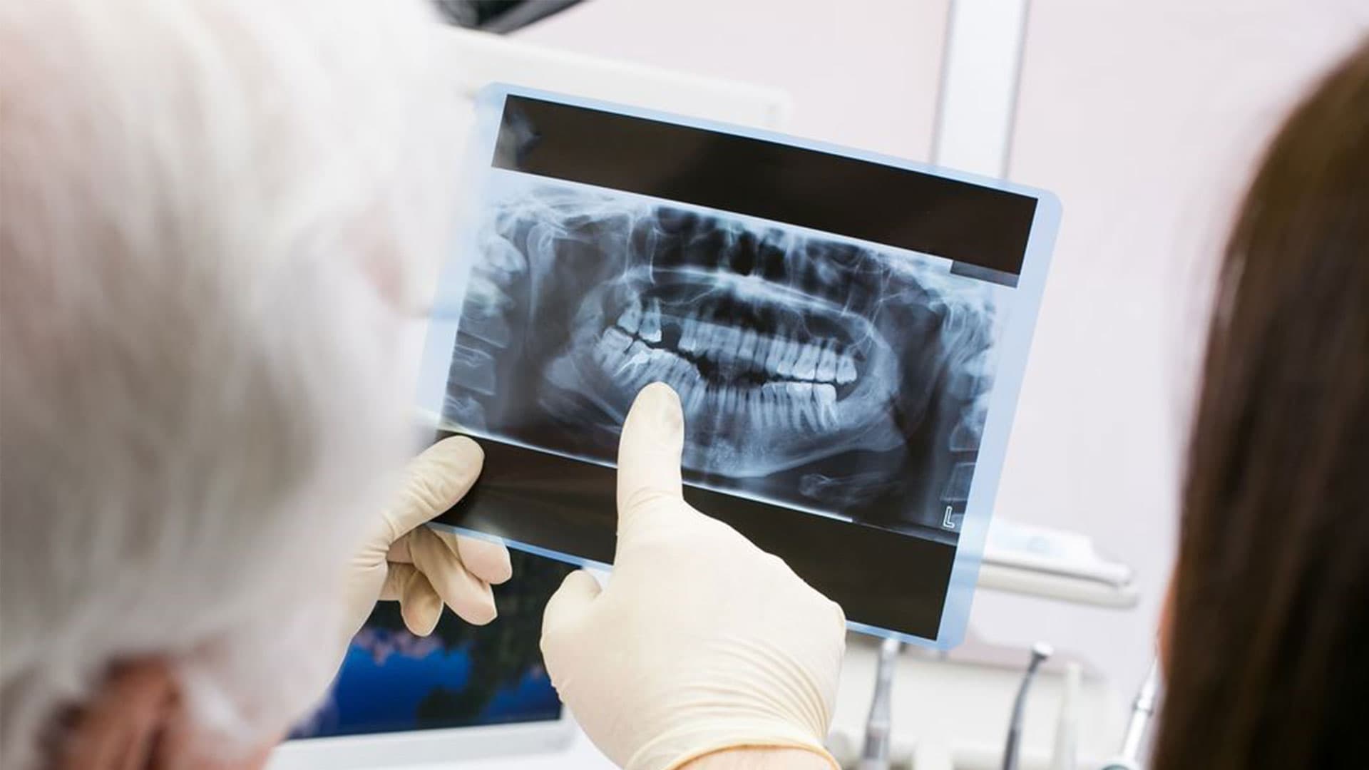 عکس رادیوگرافی دندان