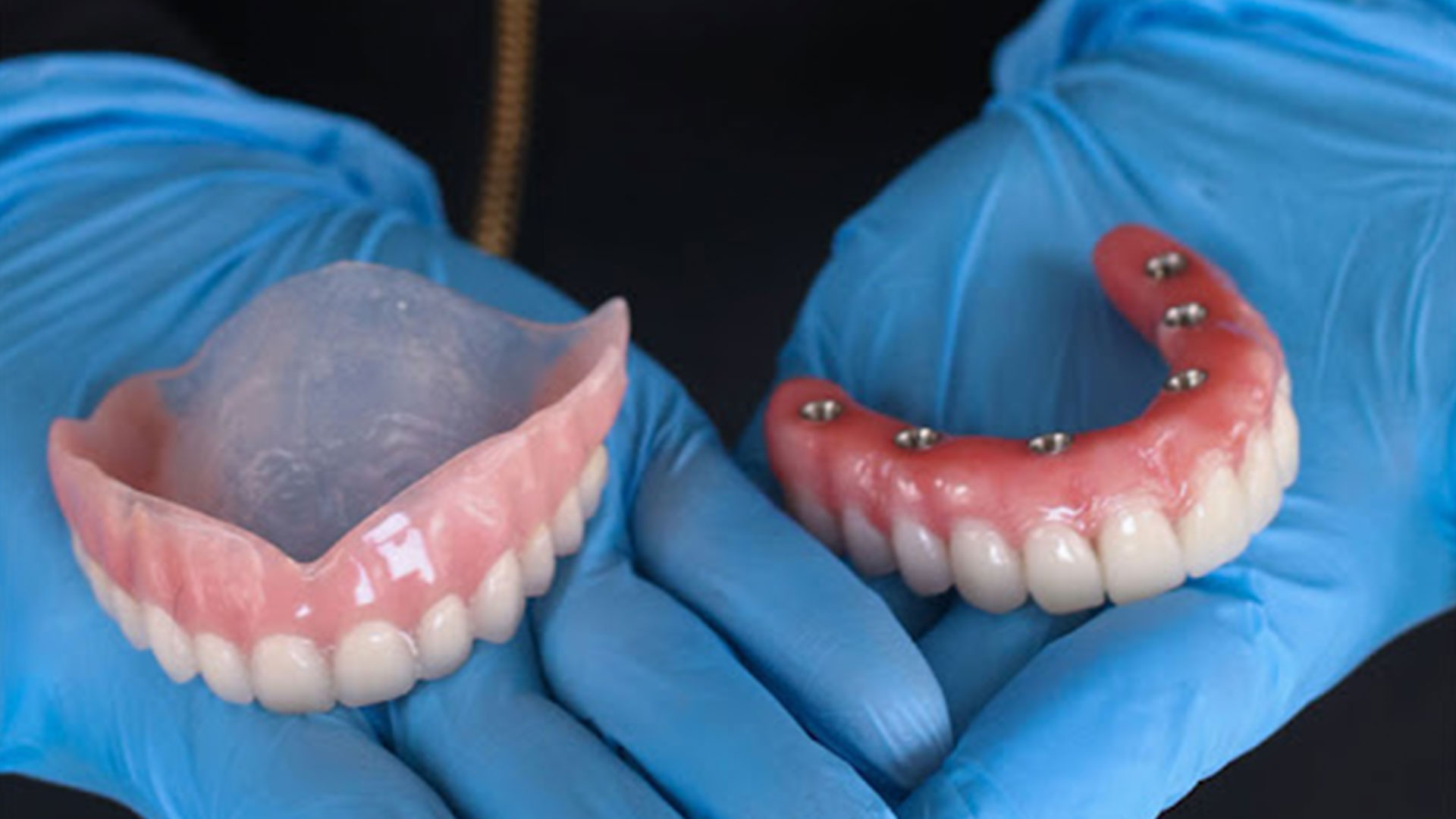 بهترین نوع دندان مصنوعی