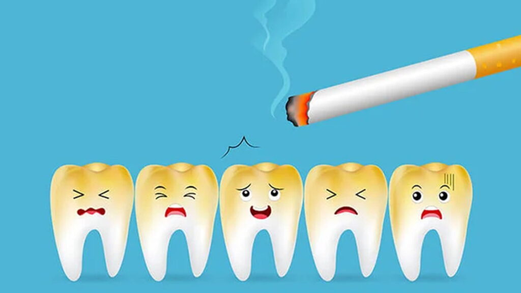 تأثیر سیگار بر سلامت دندانها